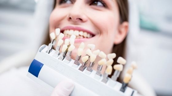 Dental Veneers - Pros and Cons