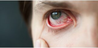 Everything You Must Know about Strain in Eyes