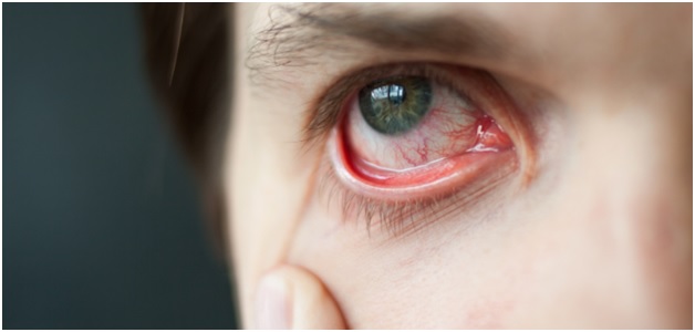 Everything You Must Know about Strain in Eyes