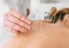What to Expect On Your First Visit to an Acupuncture Clinic