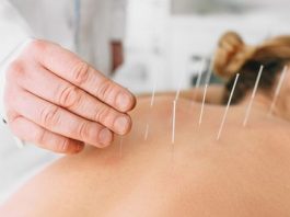 What to Expect On Your First Visit to an Acupuncture Clinic