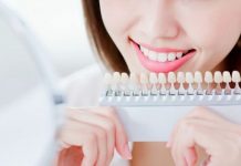 Tips for Teeth Whitening from Cedar Dentistry